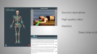 iOrtho Mobile App screenshot 4