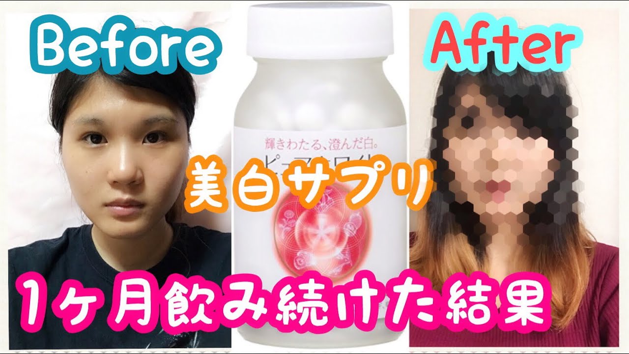 検証 小麦肌女子が美白サプリで色白になるのか資生堂の商品で試してみた Youtube