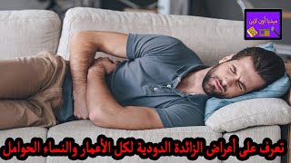 قد تهدد الحياة..تعرف على أعراض الزائدة الدودية لكل الأعمار والنساء الحوامل شاهد التفاصيل