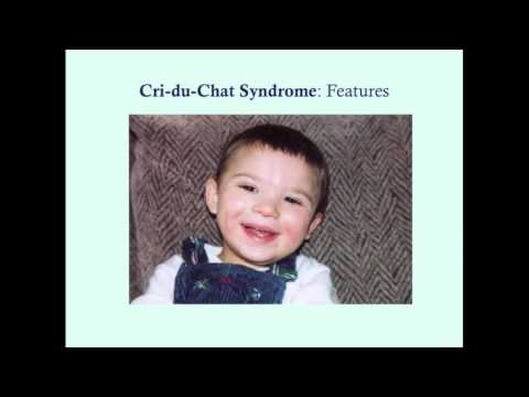 Cri du Chat - CRASH! Medical Review Series