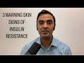 3 warning skin signs of insulin resistance precursor to diabetes
