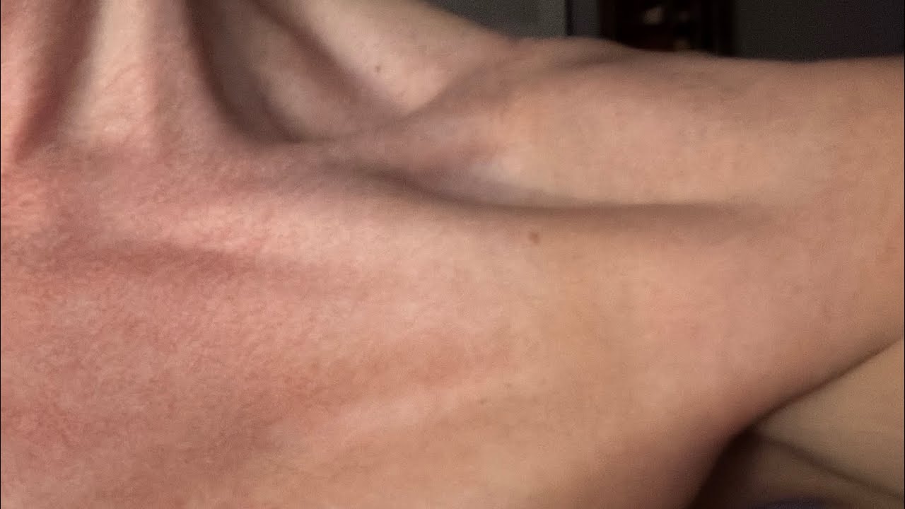Hot Rocks Into Skin Some stretching and Healing with Hot Stones - YouTube