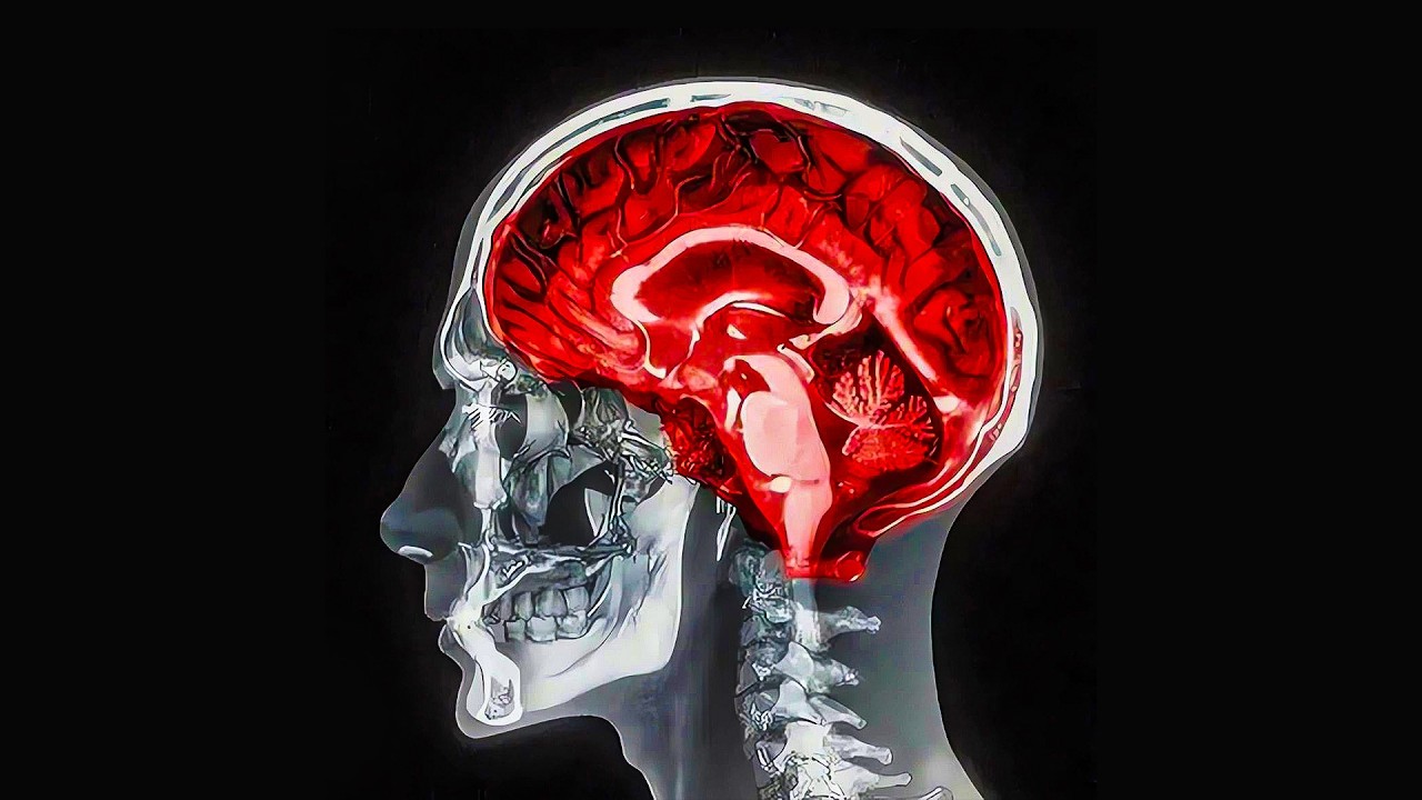 Brain Rot is Ruining Your 20s (yes, seriously!)