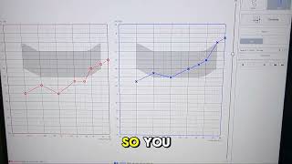 Hearing Loss Simulator 002: Severe (Right) / Moderate (Left), Reverse Ski-Slope, Mixed Hearing Loss.