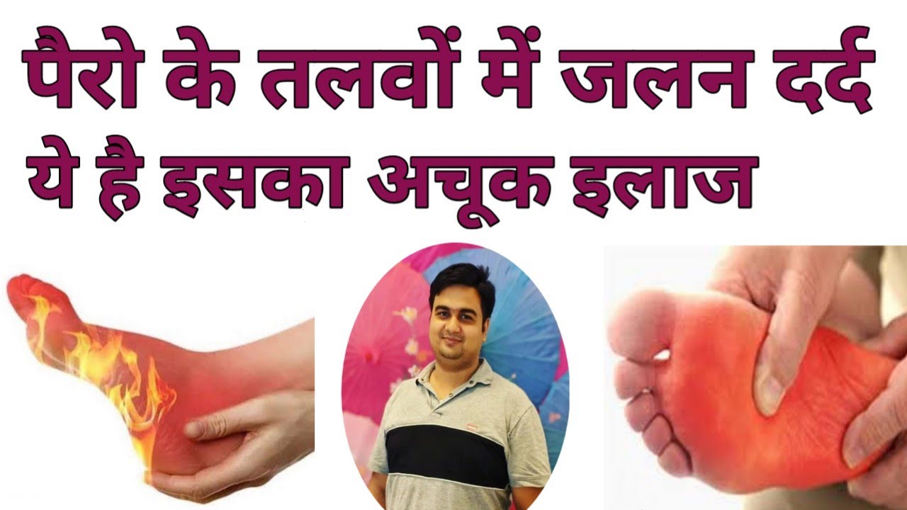 पैर के तलवे में जलन (Burning Feet Sensation) का कारड़ और इसका इलाज क्या