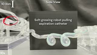 Soft robot removes mock blood clot from phantom model screenshot 1