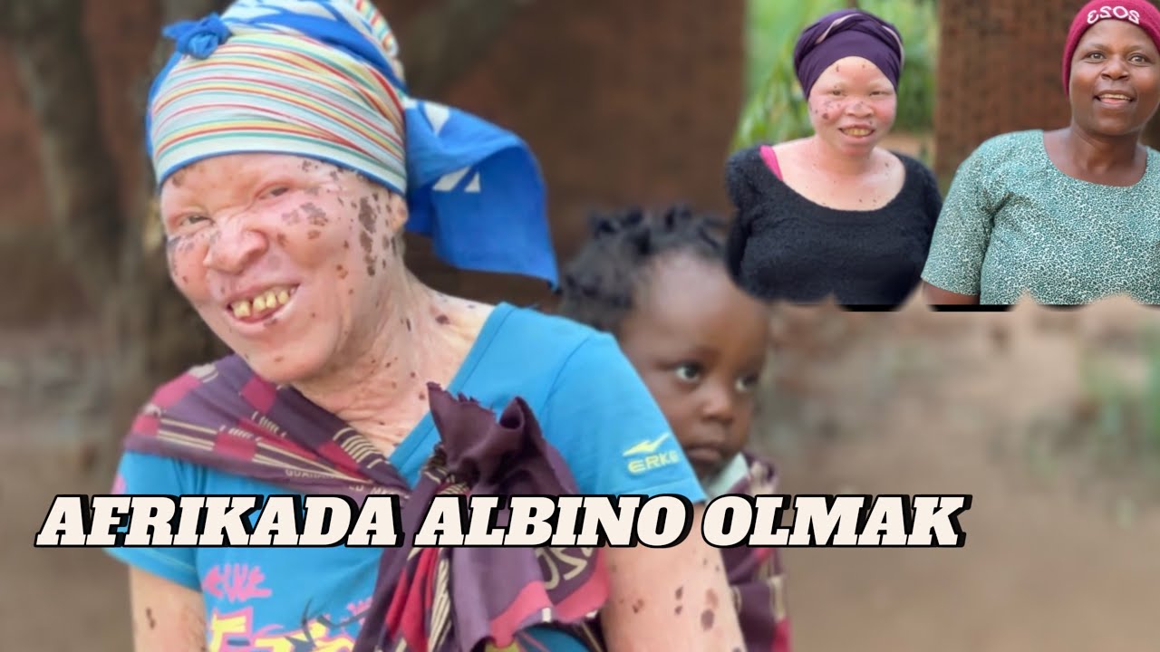 Dünyanın en fakir 4. Ülkesi Malavi