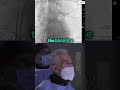 Claudio Tondo demonstrates left superior pulmonary vein isolation