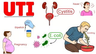 Uti Symptoms, Causes, Treatment Urinary Tract Infections Explained