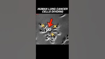 Human lung cancer cells dividing RAPIDLY! #microscope #cancer #biology #oncology #medical #science