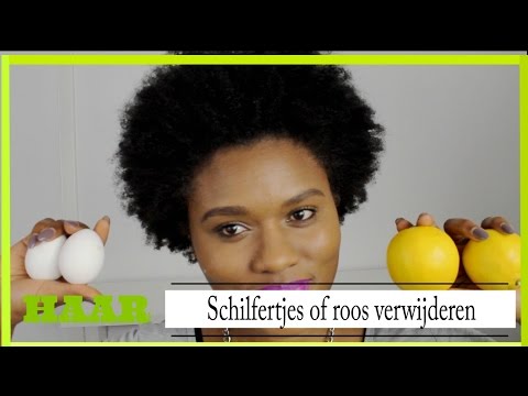 Video: Behandeling Van Seborroe Van De Hoofdhuid Thuis, Folkremedies