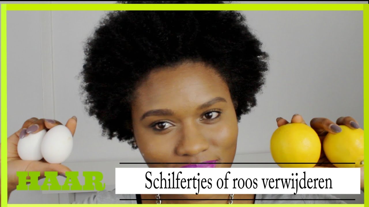 of roos verwijderen | DIY behandeling - YouTube