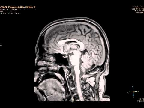 f MRI brain animation set to NIN YouTube