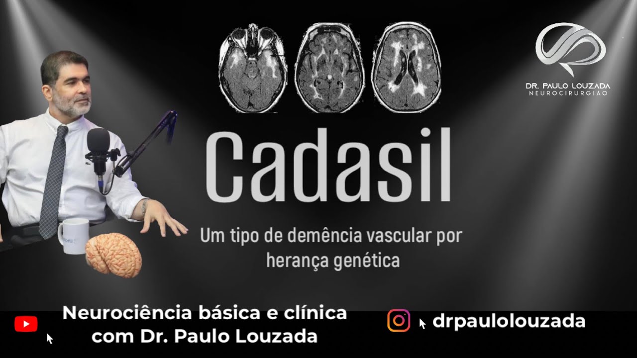Cadasil