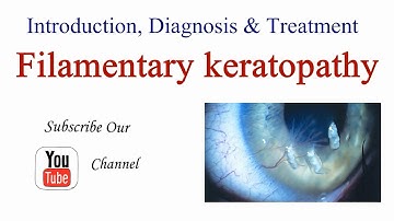 Filamentary Keratopathy / Keratitis Introduction, Causes, Diagnosis and Treatment - Optometry Club