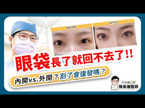 眼袋長出來是回不去的！眼袋手術要選內開或外開？割了還會復發嗎？| 陳承謙醫師