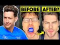 Why Jaw Trainers Are A Bad Idea & Can Hurt You (With Better