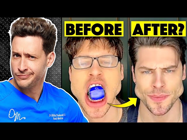 Do Jaw Trainers Actually Work?  Responding To Comments 