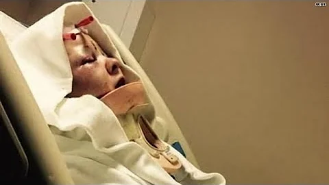 Cops: Woman scalped by ex-boyfriend and dog