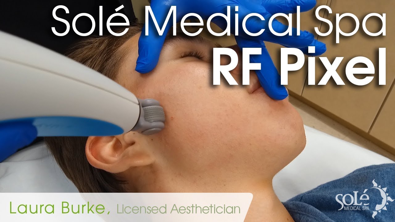 Laura Burke at Solé Medical Spa Resurface your skin with RF Pixel