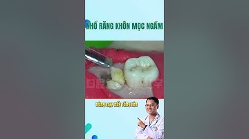 Hình ảnh về quá trình NHỔ BỎ RĂNG KHÔN mọc NGẦM #drcuong #nhakhoa #rangsua