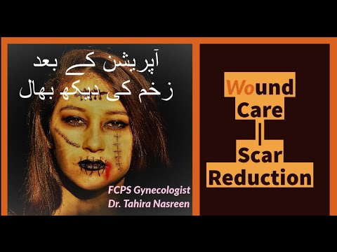 C Section Wound Treatment | Care and Scar Reduction | in Urdu/Hindi