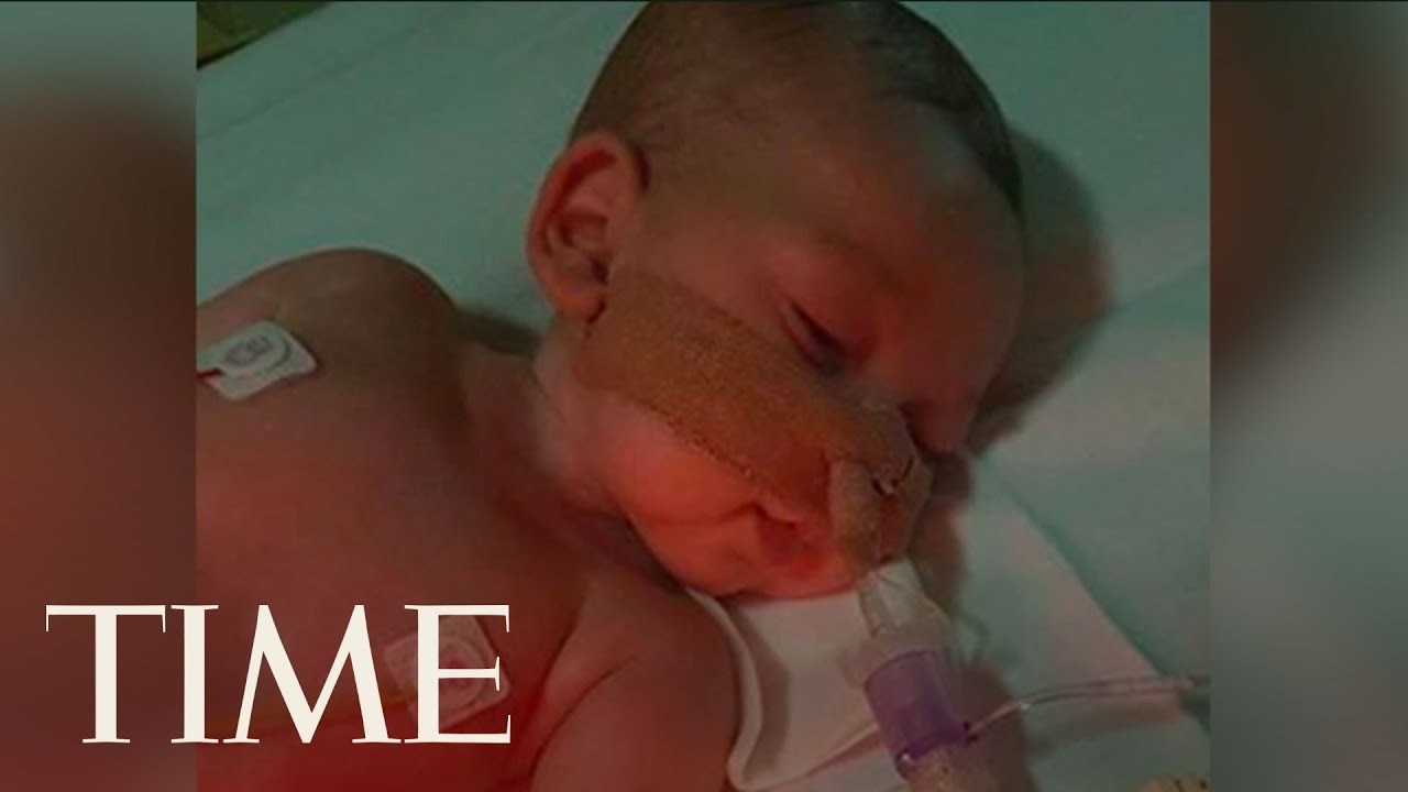 What to Know About Charlie Gard, the Terminally Ill Baby Trump Wants to Help