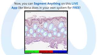 (Code Below) 𝐒𝐮𝐩𝐞𝐫𝐟𝐚𝐬𝐭 𝐒𝐞𝐠𝐦𝐞𝐧𝐭 𝐀𝐧𝐲𝐭𝐡𝐢𝐧𝐠 𝐨𝐧 𝐭𝐡𝐢𝐬 𝐅𝐑𝐄𝐄 𝐋𝐈𝐕𝐄 𝐀𝐩𝐩 𝐢𝐧 𝐲𝐨𝐮𝐫 𝐨𝐰𝐧 𝐬𝐲𝐬𝐭𝐞𝐦 𝐥𝐢𝐤𝐞 𝐌𝐞𝐭𝐚 𝐝𝐨𝐞𝐬