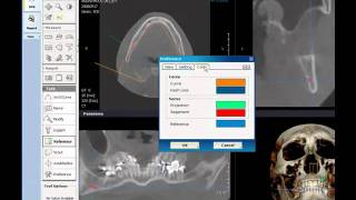 DVR (Dental Volume Reformat) Module - Preference