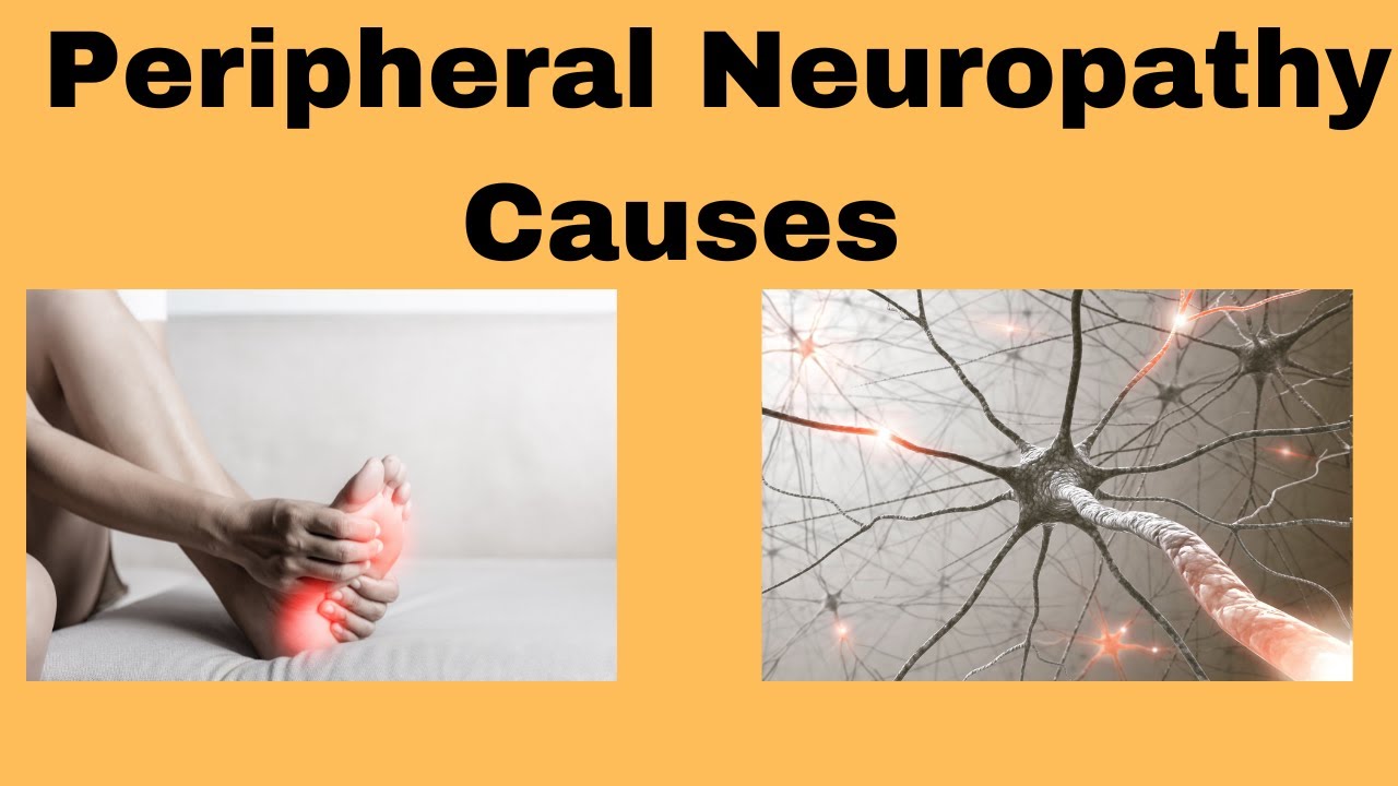 Peripheral Neuropathy Causes How The Cause Impacts Your Treatment Peripheral Neuropathy Causes How The Cause Impacts Your Treatment
