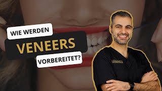 Was passiert mit den Zähnen vor der Behandlung mit Veneers? | Veneers einsetzen Teil 1