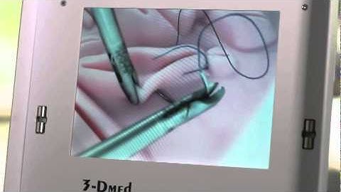 Step by Step Instructions for Laparoscopic Suturing