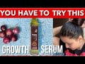 How to Use Onion Juice for Hair Growth  | Castor Oil  for Hair Growth | Preity प्रेरणा