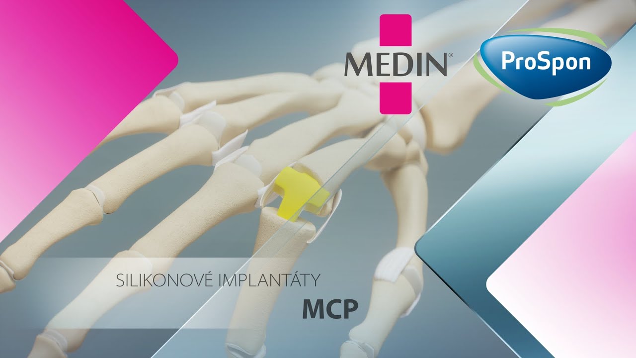 MCP - Náhrada kloubu prstního, silikonová