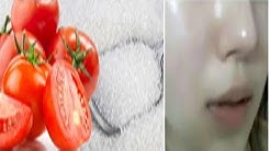 Wajib 2 Kali Sehari! Hanya Dengan Tomat Dan Gula Wajahmu Putih Berseri Bebas Flek Htam - Durasi: 5.57. 