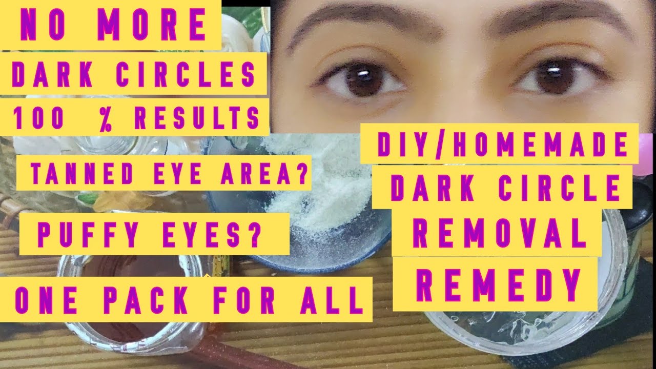 GET RID OF DARK CIRCLES/100 RESULTS) HOMEMADE DARK CIRCLES REMOVAL REMEDY YouTube
