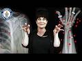 I Have Over 50 Implants In My Body! - Guinness World Records