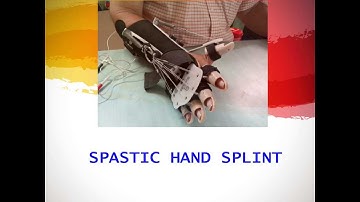 Spastic Hand Splint to reduce spasticity, improve hand function at Hope Neuro Care Hospital