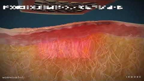 Morpheus 8 Body Animation Video