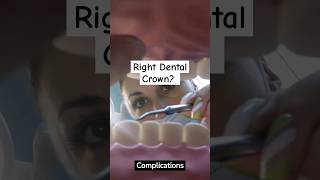 Choosing the Right Dental Crown? 🦷🤔.. #dental #youtubeshorts