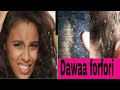 Dawwa Forforii Namarraa Baalleessuu Yeroo Gabaabaa Keessati Itti Fayyadamaa Dawwa Forforii Namarraa Baalleessuu Yeroo Gabaabaa Keessati Itti Fayyadamaa