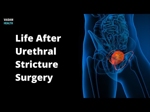 Video: Kiek laiko trunka uretrotomija?