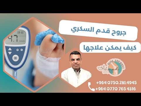 كيف يمكن علاج جروح مرضى السكري