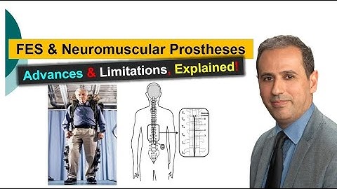 Functional Electrical Stimulation & Neuromuscular Prostheses: All You Need to Know! #BME414 #024