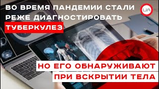 Во время пандемии стали реже диагностировать туберкулез, но его обнаруживают при вскрытии тела