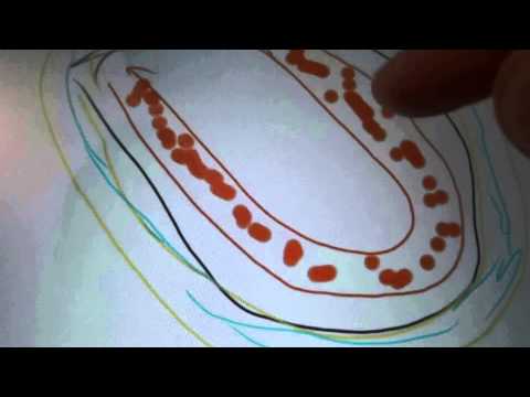 Video: Иттердеги жүрөк шишиктери (миокард)
