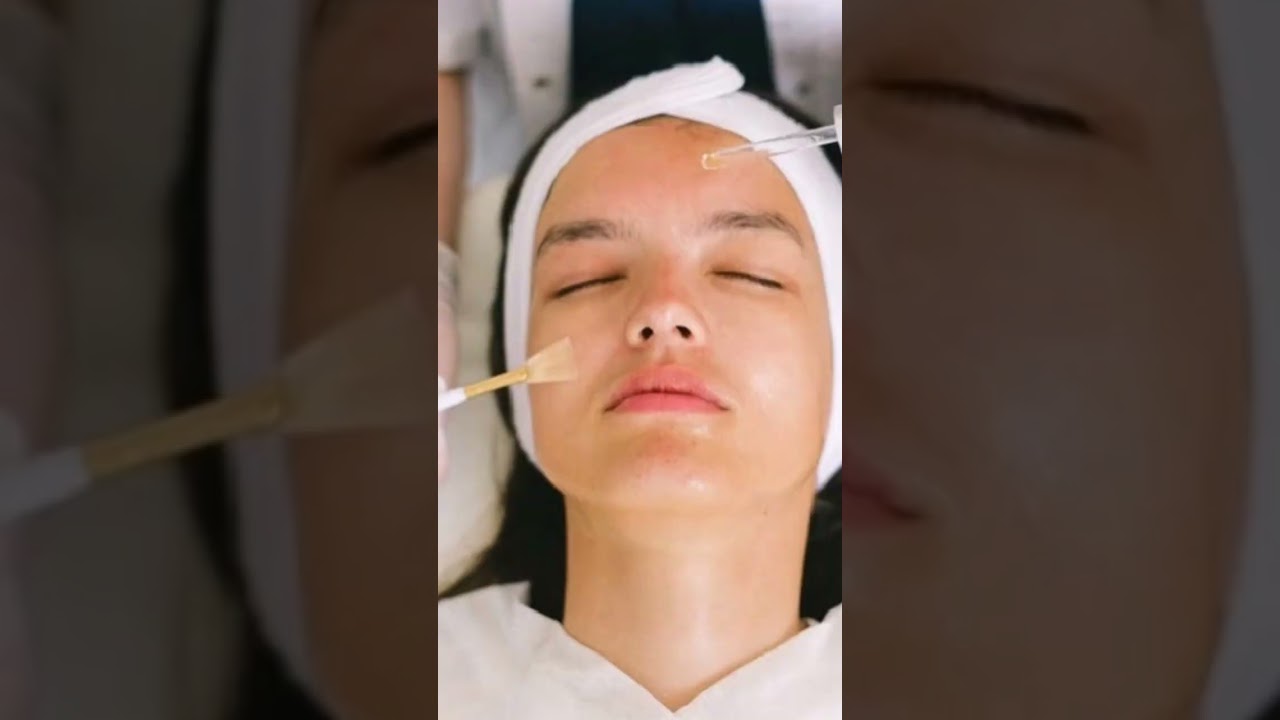 မျက်နှာအဆိပ်ထုတ် ချေးချွတ်ပြီးရင် သတိထားဖို့  #drkaungmyat #skin101aestheticclinic #skincaretips