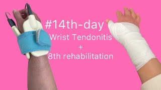 #14th-day Wrist Tendonitis + 8th rehabilitation