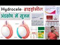 Hydrocele | अंडकोष में सूजन | Medicine | Treatment | Hydrocele Treatment | Male problem | Doctor