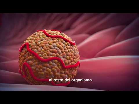 Vídeo: Ateroma: Tratamiento, Eliminación, Causas